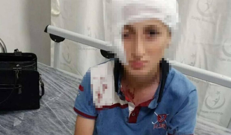 İzmir’de köpek saldırısında 1.2 milyon lira tazminat kararı