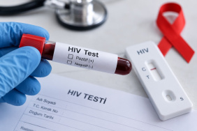 Karabağlar'da Kimliksiz Ücretsiz HIV Test Merkezi Açıldı